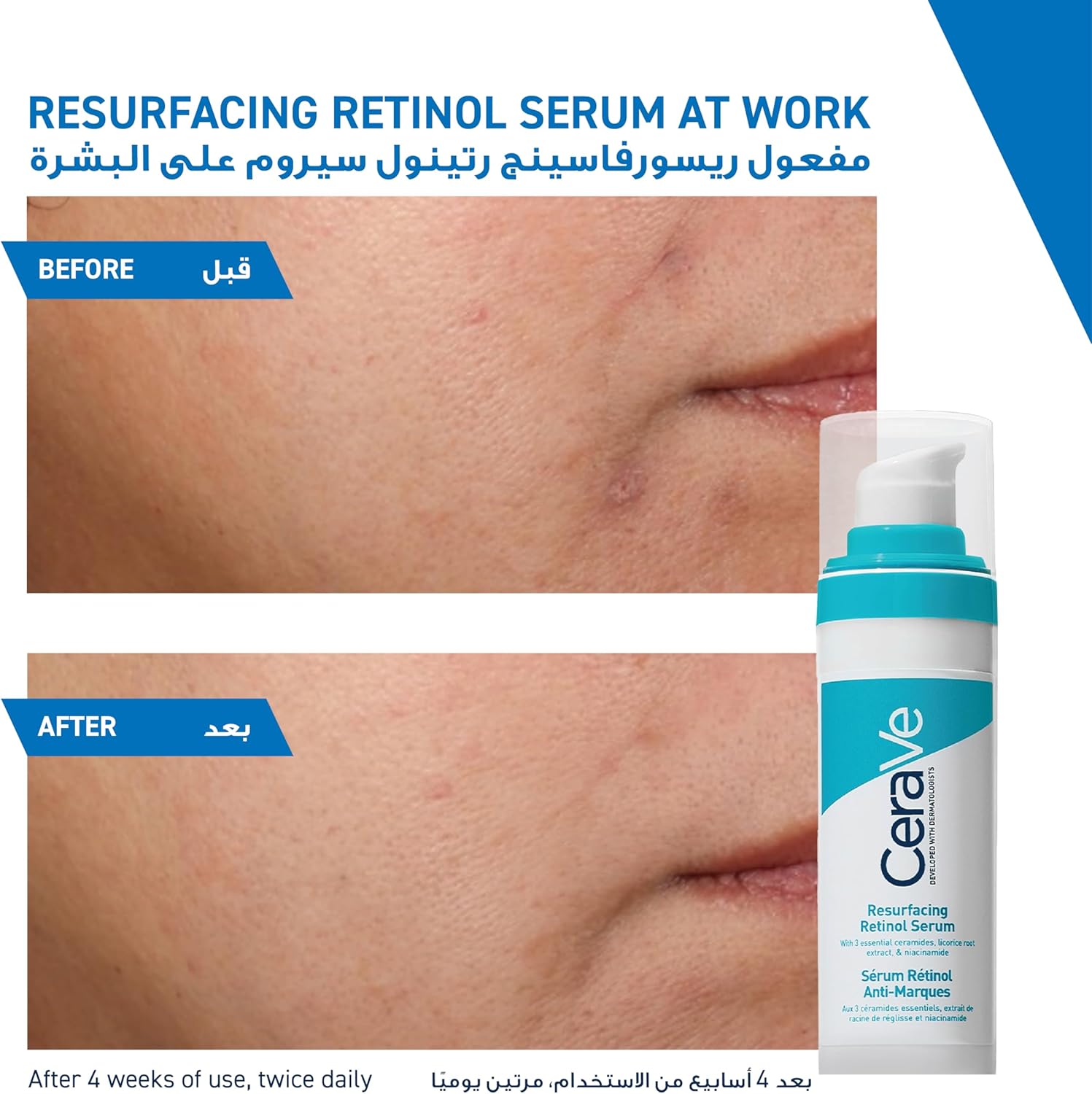 CeraVe -Resurfacing Retinol Serum