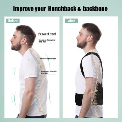 Instant Posture Corrector – مصحح وضعية فوري